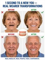 Denture accessory set for a comfortable fit - Image 2