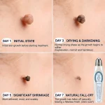Healrize® 🖊 Advanced Wart & Skin Tag Removal Pen - Image 8