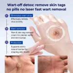 Healrize® 🖊 Advanced Wart & Skin Tag Removal Pen - Image 5