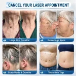 Healrize® 🖊 Advanced Wart & Skin Tag Removal Pen - Image 6
